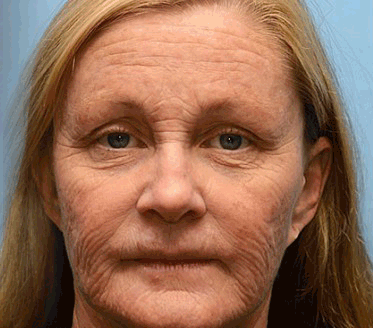 Last Day! 70% OFF 💫 Botox & Vita-A Retinol Wrinkle-Lift Cream – Made & Shipped from CA 🔥 - Image 14