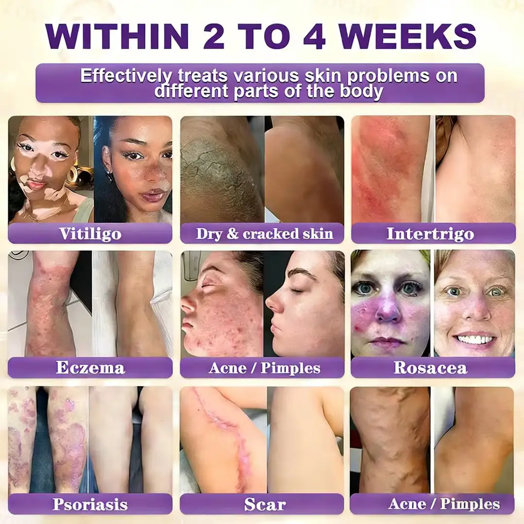 Made and Shipped from UK Biotin 10-in-1 Skin Restoration Cream - Image 2