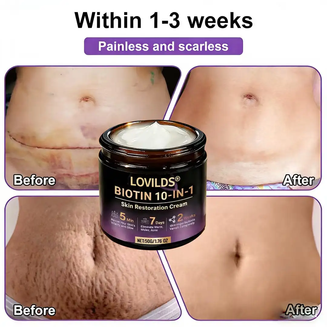 Made and Shipped from UK Biotin 10-in-1 Skin Restoration Cream - Image 5