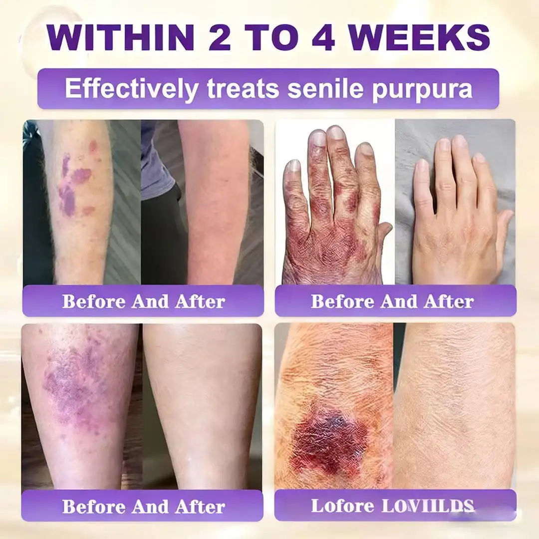 Made and Shipped from UK Biotin 10-in-1 Skin Restoration Cream🌻🌻 - Image 6