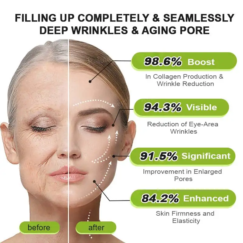 moringa & Vita-A Retinol Shot Wrinkle-Lift Tightening cream - Last Day Promotion 70% OFF - Image 16