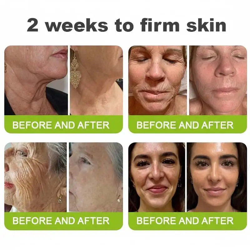 moringa & Vita-A Retinol Shot Wrinkle-Lift Tightening cream - Last Day Promotion 70% OFF - Image 7
