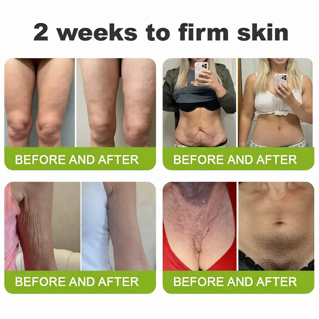 🧠👨⚕️Made and shipped from the USA Botin & Vita-A Retinol Shot Wrinkle-Lift Tightening cream - Last Day Promotion 50% OFF - Image 5