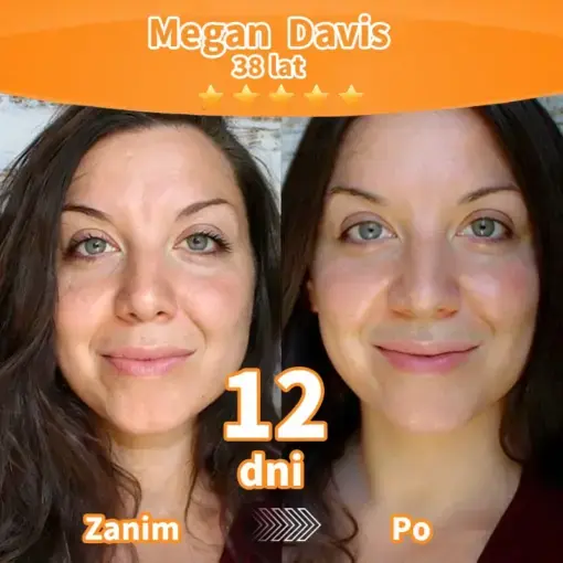 Stem Cell Extract EGF and Copper Peptide Revitalizing Essence Cream - Image 5