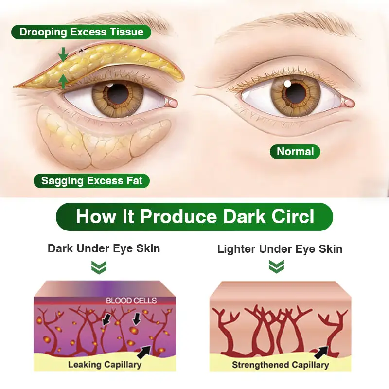 Pepti-Tox & Caffeine Shot Wrinkle-Lift Depuffing Microdart Patch - Image 2