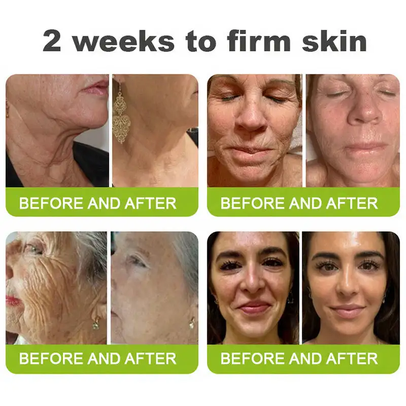 USA's #1 Skin Tightening Secret 🇺🇸 Retinol Shot: Firm & Lift 🎁 GET 50% OFF (Last Chance) - Image 7