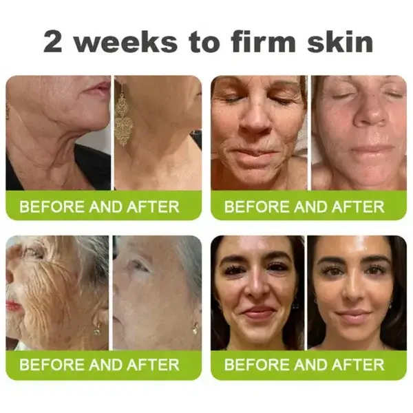 Retinol Shot: Firm & Lift - Image 7