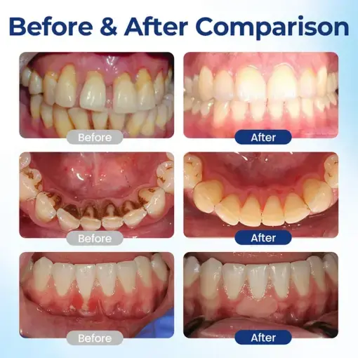 BeeTakt Oral Repair Solution Apitoxin - Image 3