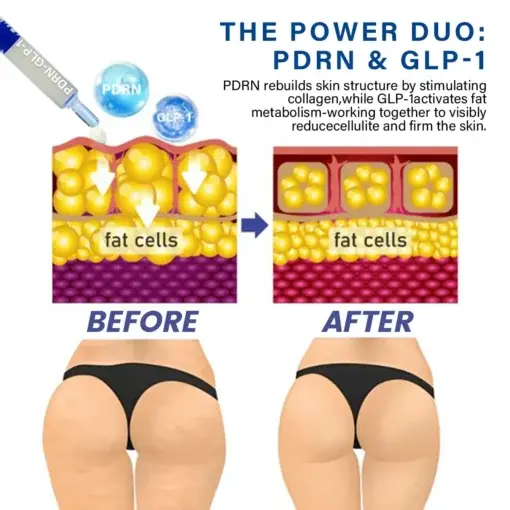 ๐๐ฅ๐ข๐ฆ๐ฆ๐ข๐ง๐ & ๐๐ฅ๐จ๐จ๐ ๐๐ฎ๐ ๐๐ซ ๐๐๐ ๐ฎ๐ฅ๐๐ญ๐ข๐ง๐ ๐๐๐๐๐ฅ๐ ๐๐ก๐จ๐ญ ๐๐๐ซ๐ฎ๐ฆ - Image 3