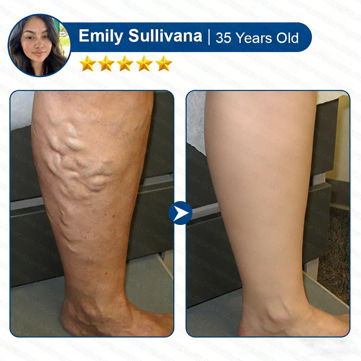 ๐ฝ๐ฒ๐ถ๐ฃ ๐พ๐จ๐ง๐๐ผ๐ช๐ง ๐๐๐๐ซ๐๐๐๐ฒ๐ฑ๐น๐ ๐๐๐ญ๐๐ ๐๐๐๐ต ๐๐๐ซ๐๐ฃ๐๐๐ - Image 14