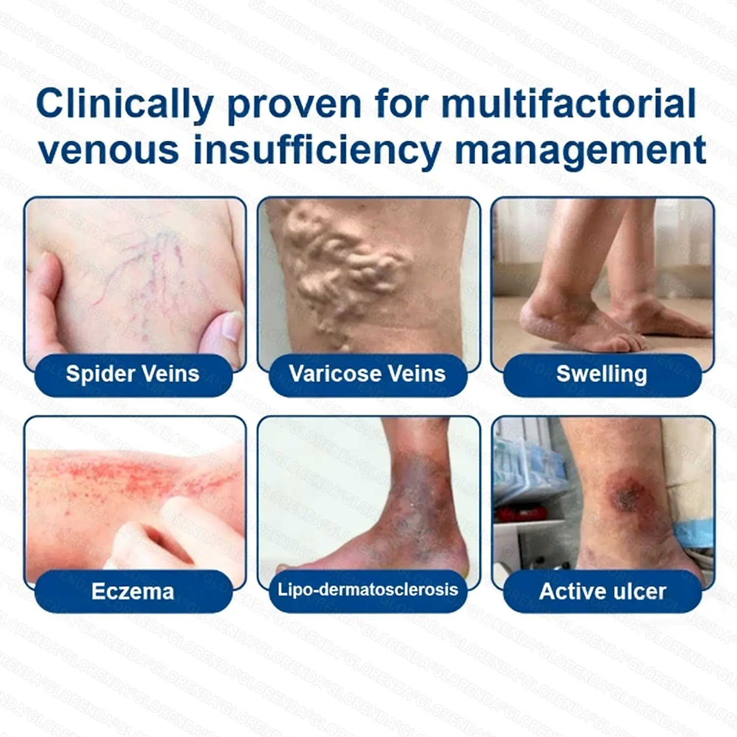 ๐ฝ๐ฒ๐ถ๐ฃ ๐พ๐จ๐ง๐๐ผ๐ช๐ง ๐๐๐๐ซ๐๐๐๐ฒ๐ฑ๐น๐ ๐๐๐ญ๐๐ ๐๐๐๐ต ๐๐๐ซ๐๐ฃ๐๐๐ - Image 2