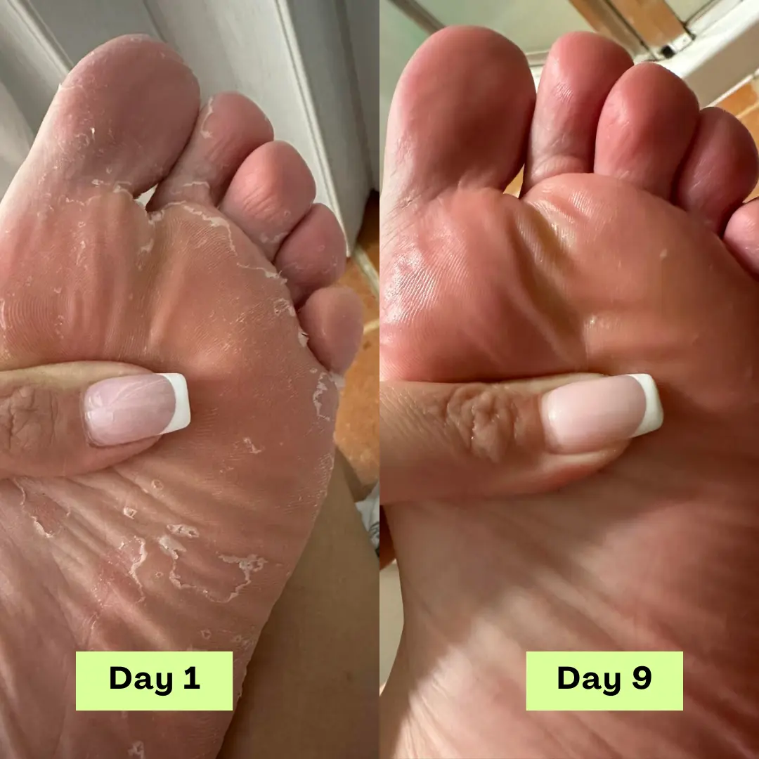 Antifungal Tea Tree Soap Bar - Image 10