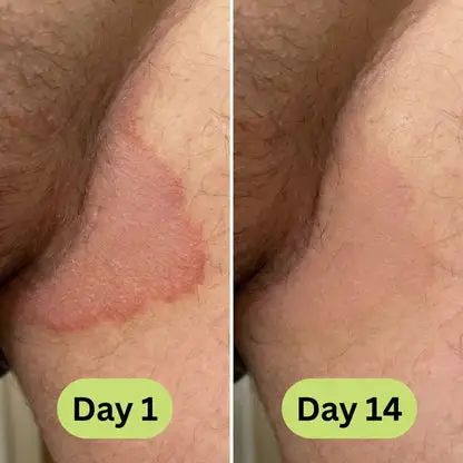 Antifungal Tea Tree Soap Bar - Image 12