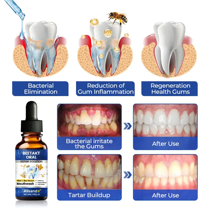 BeeTakt Oral Repair Solution - Image 14