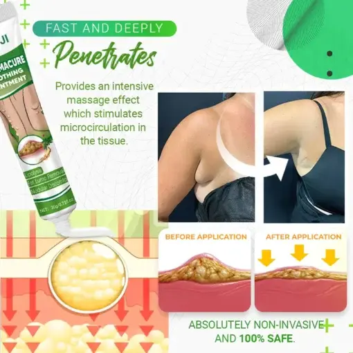LipomaCure Soothing Ointment - Image 8