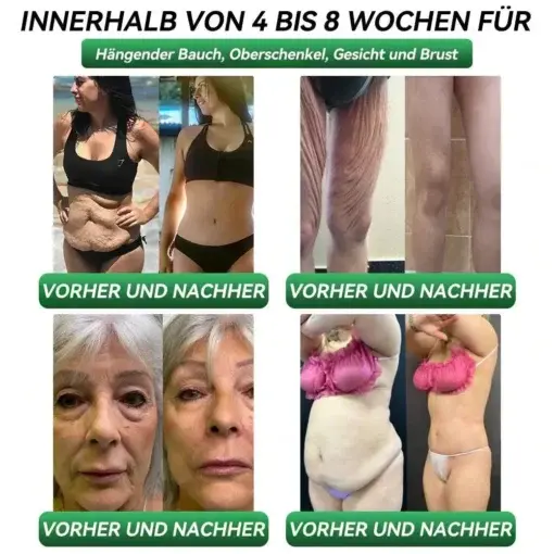 ๐ฆ๐ฐ๐ต๐น๐ฎ๐ป๐ธ๐ต๐ฒ๐ถ๐๐- & ๐๐ฒ๐๐๐ป๐ฑ๐ต๐ฒ๐ถ๐๐-๐ง๐ฟ๐ผ๐ฝ๐ณ๐ฒ๐ป - Image 2