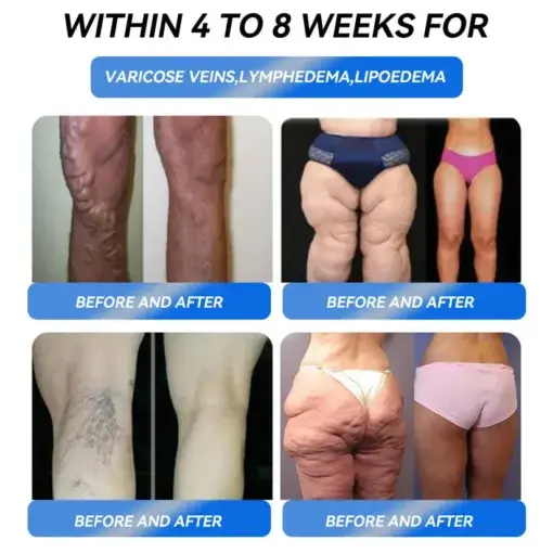 Slimming Support Drops - Image 5