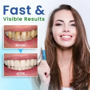 Alternative view of Teeth Whitening Pen