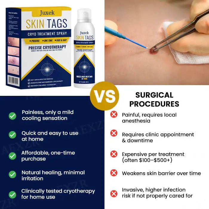 Skin Tag Cryo Treatment Spray - Image 8