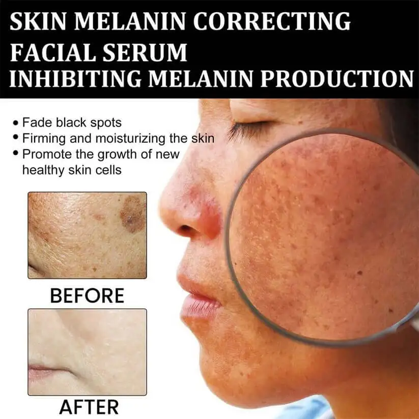 Melanin Correcting Facial Serum - Image 2