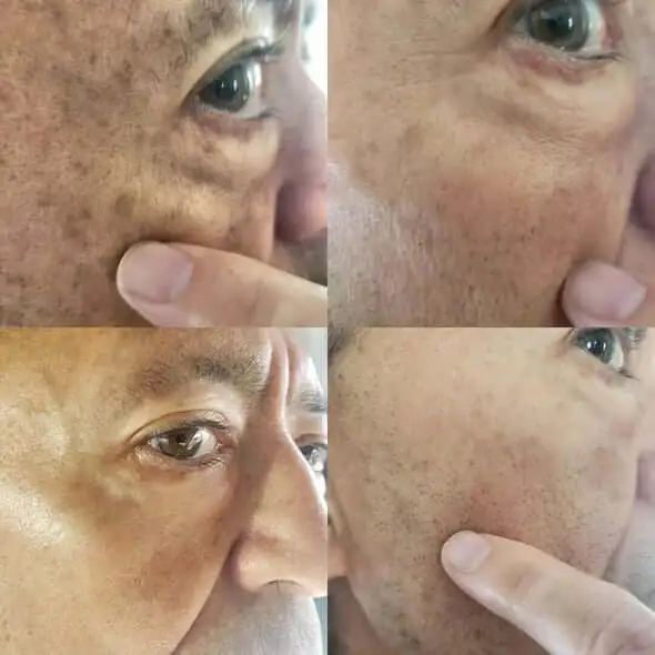 Melanin Correcting Facial Serum - Image 6