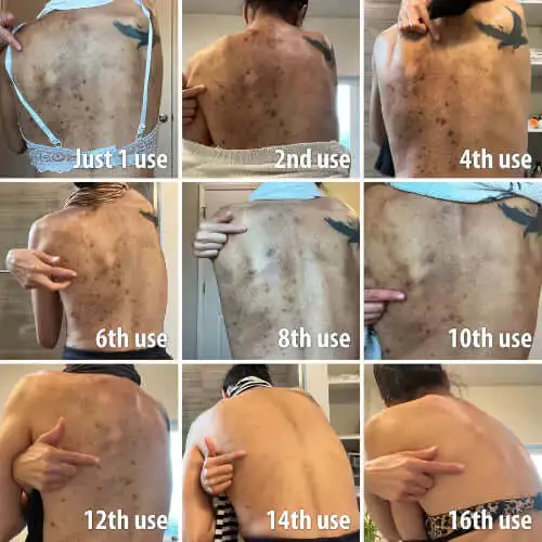 Melanin Correcting Facial Serum - Image 7