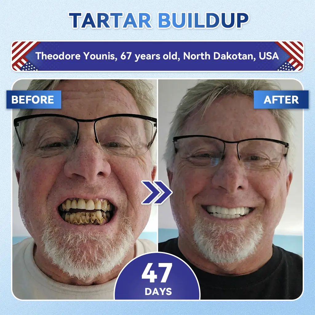 Tideglusib Fast‑Dissolving Tooth & Gum Repair Oral Strips - Image 4