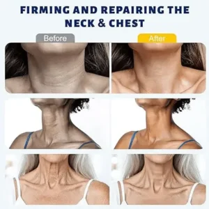 Alternative view of ✨ Roller Massage Cream — 🧴 Infused with Retinol & Hyaluronic Acid